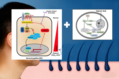 What is PTD-DBM with valproic acid What is PTD-DBM with valproic acid